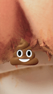 Destroyed ass closeup poop after anal