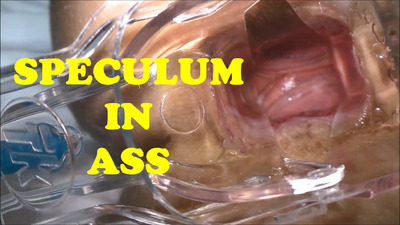 Speculum in ass & Ass fisting