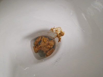 Scat 301: diarrhea