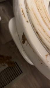 Diarrhea Disaster: Aiming Gone Wrong