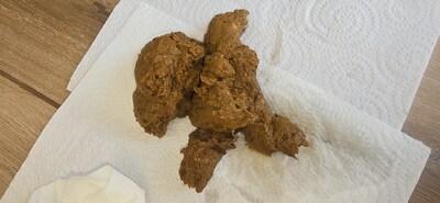 Scat 374: pasty and noodle "worms"