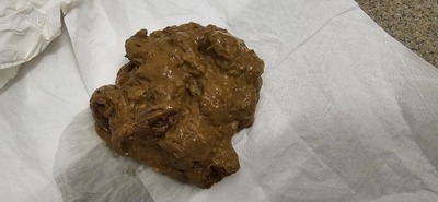 Scat 376: full of spaghetti "worms!"