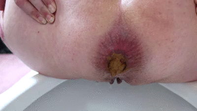 Gassy Behind And Between