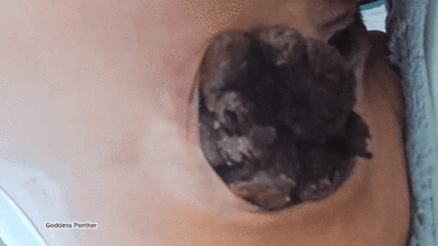 Strain Constipsted Turds