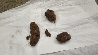 Scat 407: I'm constipated