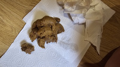 Scat 418: Huge, gloopy scat!