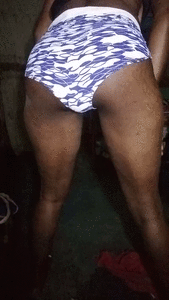 Katze poop white poop