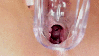 S PECULUM DISRTYTALK