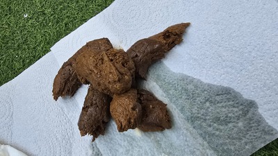 Scat 465: large, hard, and soft donut