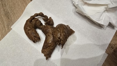 Scat 473: I'm pretty constipated