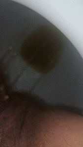 Diarrhea Compilation