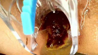 S PECULUM POOP ANAL PEE