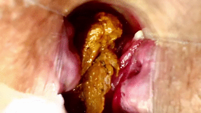 POOP GAPE ASS S PECULUM