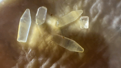 Suffering with suppositories