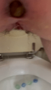 Pee and shit