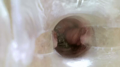 POOP SPECULUM IN ASS
