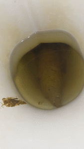 MONSTER SHIT CLOGGING TOILET !!!