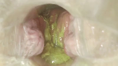 POOP ANAL PEE FARTS