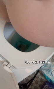 OIL + MILKSHAKE INDUCED EXPLOSIVE DIARRHEA
