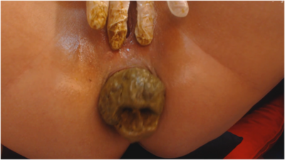 #20 digging into my shit-filled ass