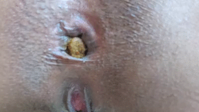 It almost tore my anus