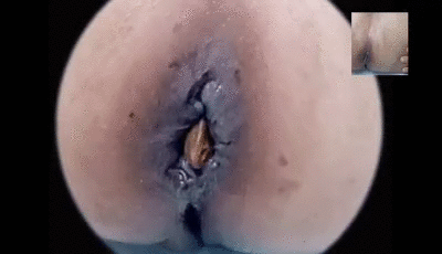Eat my ass